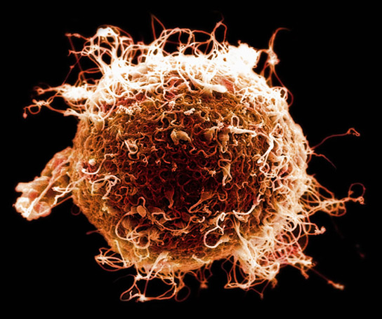 Human egg being fertilized